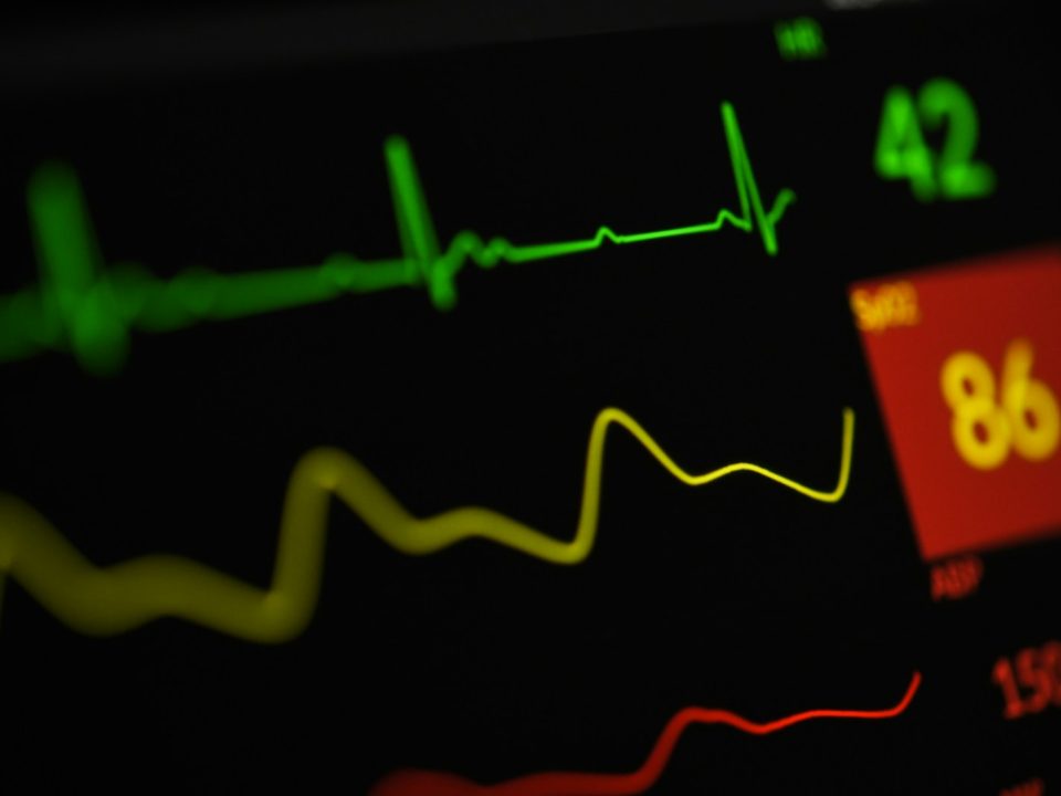 a close up of a monitor screen with a heart beat